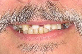 Smile Before Treatment